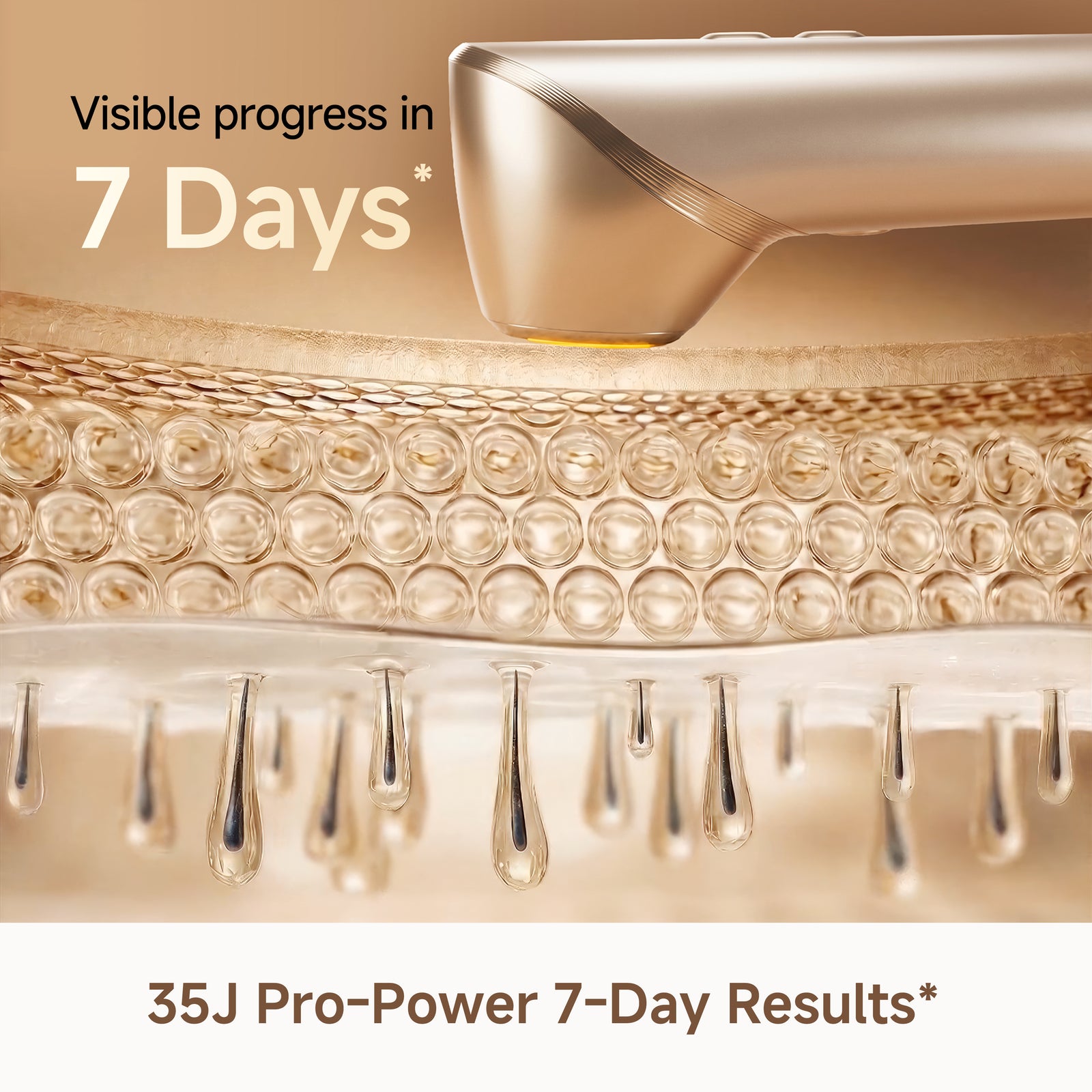Dreame Astra IPL Hair Removal Device