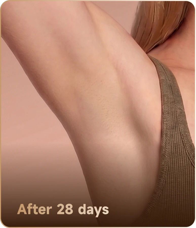 After 28 days