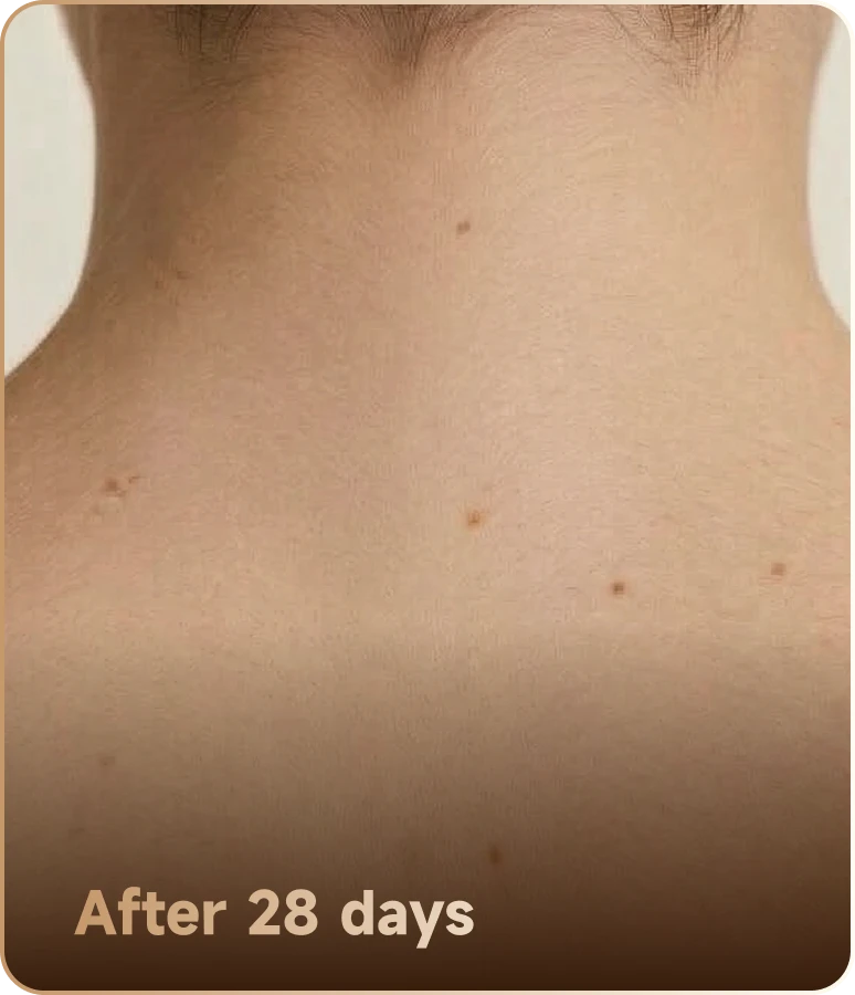 After 28 days